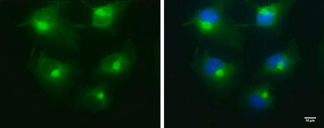 Monoclonal Anti-BICD2 antibody produced in mouse clone GT10811, affinity isolated antibody