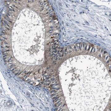 Anti-LRIG2 antibody produced in rabbit Prestige Antibodies&#174; Powered by Atlas Antibodies, affinity isolated antibody, buffered aqueous glycerol solution