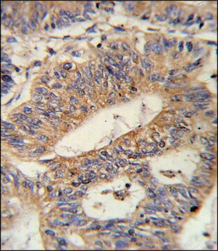 ANTI-IL17RB (CENTER) antibody produced in rabbit IgG fraction of antiserum, buffered aqueous solution