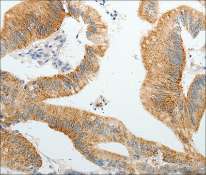 Anti-PGBD5 antibody produced in rabbit affinity isolated antibody