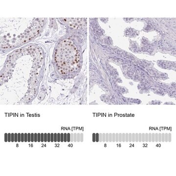 Anti-TIPIN antibody produced in rabbit Prestige Antibodies&#174; Powered by Atlas Antibodies, affinity isolated antibody, buffered aqueous glycerol solution