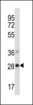 ANTI-NDFIP1 (CENTER) antibody produced in rabbit IgG fraction of antiserum, buffered aqueous solution