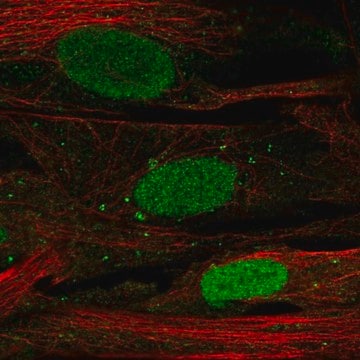 Anti-SHOX antibody produced in rabbit Prestige Antibodies&#174; Powered by Atlas Antibodies, affinity isolated antibody