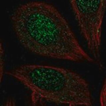 Anti-CHST7 antibody produced in rabbit Prestige Antibodies&#174; Powered by Atlas Antibodies, affinity isolated antibody, buffered aqueous glycerol solution