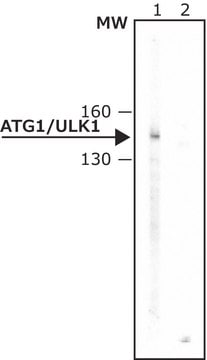 抗Atg1/ULK1 ~1&#160;mg/mL, affinity isolated antibody, buffered aqueous solution