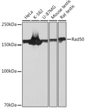 Anti-Rad50 Antibody, clone 5M2K10, Rabbit Monoclonal