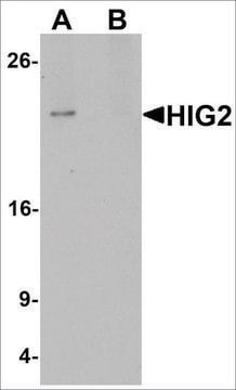 Anti-HIGD2A antibody produced in rabbit affinity isolated antibody