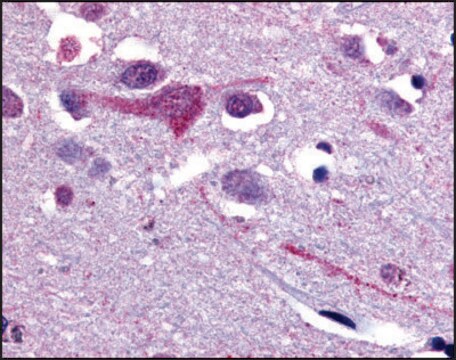 Anti-SLC5A9 (AB1) antibody produced in rabbit affinity isolated antibody, buffered aqueous solution