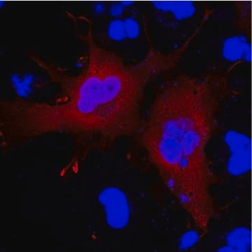 Anti-Serpin B9 Antibody, clone 7D8 clone 7D8, from mouse