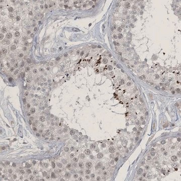 Anti-ZNF674 antibody produced in rabbit Prestige Antibodies&#174; Powered by Atlas Antibodies, affinity isolated antibody, buffered aqueous glycerol solution