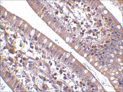 Anti-CIDE-B (ab2) antibody produced in rabbit affinity isolated antibody, buffered aqueous solution