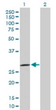 Anti-SPSB2 antibody produced in rabbit purified immunoglobulin, buffered aqueous solution