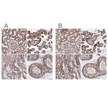 Anti-GFM1 antibody produced in rabbit Prestige Antibodies&#174; Powered by Atlas Antibodies, affinity isolated antibody, buffered aqueous glycerol solution