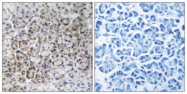 Anti-MRPL40 antibody produced in rabbit affinity isolated antibody