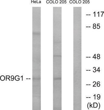 Anti-OR9G1 antibody produced in rabbit affinity isolated antibody