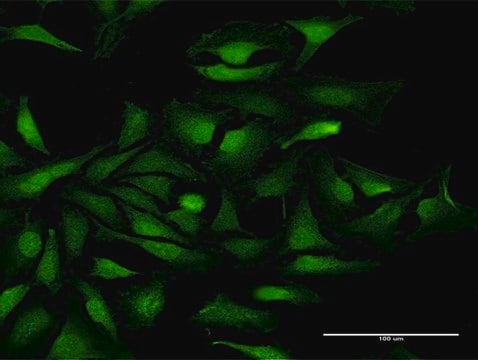 Anti-KIAA0101 antibody produced in mouse purified immunoglobulin, buffered aqueous solution