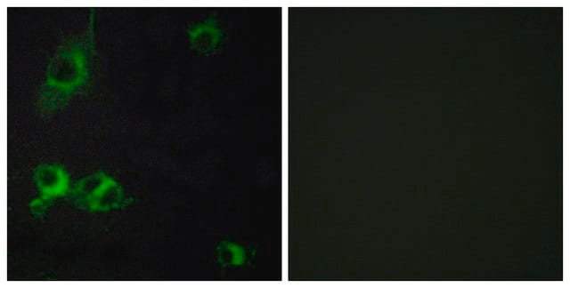 Anti-LAMA1 antibody produced in rabbit affinity isolated antibody