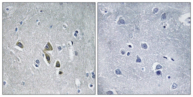 Anti-OAZ1 antibody produced in rabbit affinity isolated antibody