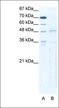 Anti-TBX5 antibody produced in rabbit affinity isolated antibody