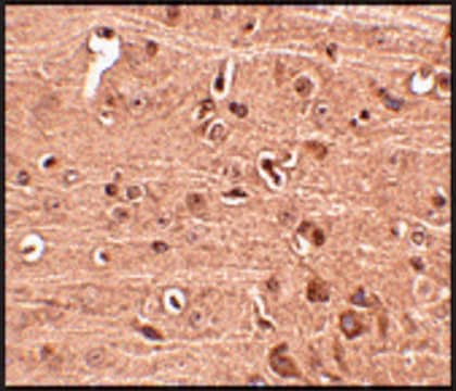 Anti-GLE1 (ab1) antibody produced in rabbit affinity isolated antibody, buffered aqueous solution