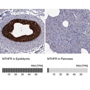 Anti-MTHFR antibody produced in rabbit Prestige Antibodies&#174; Powered by Atlas Antibodies, affinity isolated antibody, buffered aqueous glycerol solution