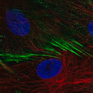 Anti-SCN9A antibody produced in rabbit Prestige Antibodies&#174; Powered by Atlas Antibodies, affinity isolated antibody