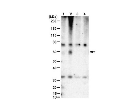 Anty-fosfo-CaMKII beta (Ser331) from rabbit, purified by affinity chromatography