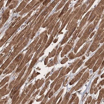 Anti-ZFYVE16 antibody produced in rabbit Prestige Antibodies&#174; Powered by Atlas Antibodies, affinity isolated antibody, buffered aqueous glycerol solution