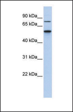 Anti-CSNK1G1 antibody produced in rabbit affinity isolated antibody