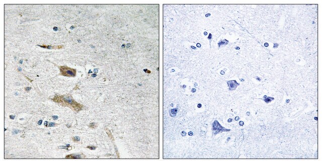 Anti-ABHD4 antibody produced in rabbit affinity isolated antibody