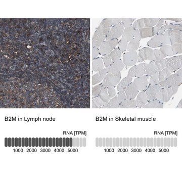 Anti-B2M antibody produced in rabbit Prestige Antibodies&#174; Powered by Atlas Antibodies, affinity isolated antibody, buffered aqueous glycerol solution