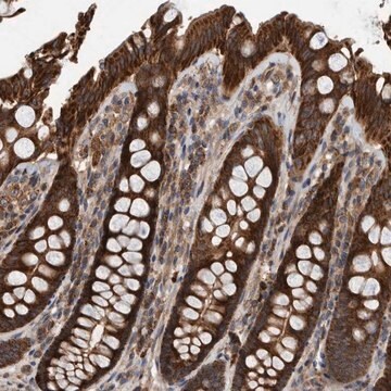 Anti-ABCA5 antibody produced in rabbit Prestige Antibodies&#174; Powered by Atlas Antibodies, affinity isolated antibody, buffered aqueous glycerol solution