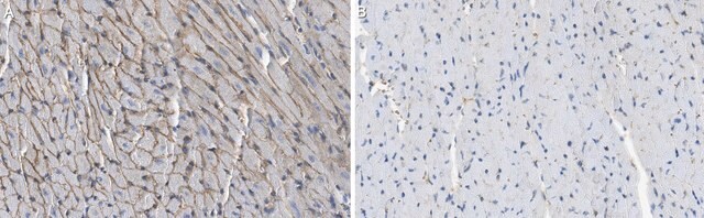 Anti-&#945;-Dystroglycan Antibody