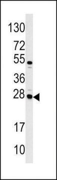 ANTI-CASA (CENTER) antibody produced in rabbit purified immunoglobulin, buffered aqueous solution