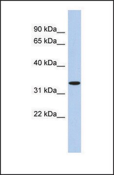 Anti-ASPA, (N-terminal) antibody produced in rabbit affinity isolated antibody