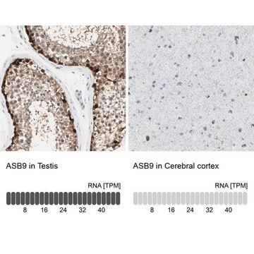 Anti-ASB9 antibody produced in rabbit Ab2, Prestige Antibodies&#174; Powered by Atlas Antibodies, affinity isolated antibody, buffered aqueous glycerol solution