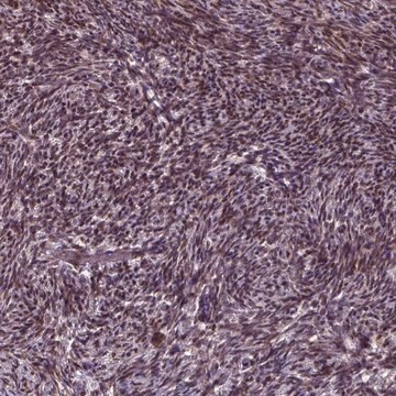 Anti-ZNF630 antibody produced in rabbit Prestige Antibodies&#174; Powered by Atlas Antibodies, affinity isolated antibody