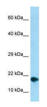 Anti-NUPR1 (C-terminal) antibody produced in rabbit affinity isolated antibody