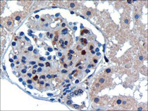 Anti-UBE2I antibody produced in goat affinity isolated antibody, buffered aqueous solution