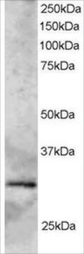 Anti-GCIP-Interacting Protein P29 antibody produced in goat affinity isolated antibody, buffered aqueous solution