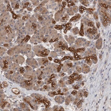 Anti-SMAP2 antibody produced in rabbit Prestige Antibodies&#174; Powered by Atlas Antibodies, affinity isolated antibody, buffered aqueous glycerol solution, Ab2