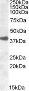 Anti-ERCC1 antibody produced in goat affinity isolated antibody, buffered aqueous solution