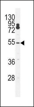 ANTI-CPSF7(C-TERMINAL) antibody produced in rabbit affinity isolated antibody, buffered aqueous solution