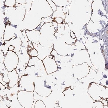 Anti-TUSC5 antibody produced in rabbit Prestige Antibodies&#174; Powered by Atlas Antibodies, affinity isolated antibody, buffered aqueous glycerol solution