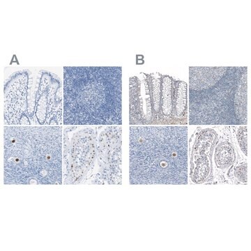 Anti-SALL4 antibody produced in rabbit Prestige Antibodies&#174; Powered by Atlas Antibodies, affinity isolated antibody, buffered aqueous glycerol solution