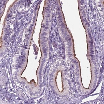 Anti-AP5B1 antibody produced in rabbit Prestige Antibodies&#174; Powered by Atlas Antibodies, affinity isolated antibody, buffered aqueous glycerol solution