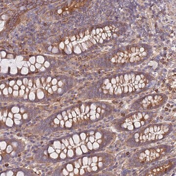 Anti-REM1 antibody produced in rabbit Prestige Antibodies&#174; Powered by Atlas Antibodies, affinity isolated antibody, buffered aqueous glycerol solution