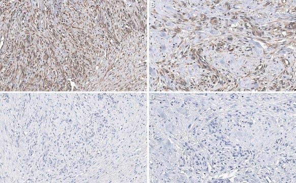 Anti-sACDY10 Antibody, clone R21