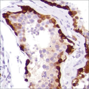 Anti-MAGE-A1 antibody, Rabbit monoclonal recombinant, expressed in proprietary host, clone SP188, affinity isolated antibody