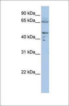 Anti-DLAT antibody produced in rabbit affinity isolated antibody